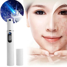 Carregar imagem no visualizador da galeria, Caneta Laser Tratamento de Varizes e Acne Original